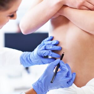 Post Bariatrik Cerrahi